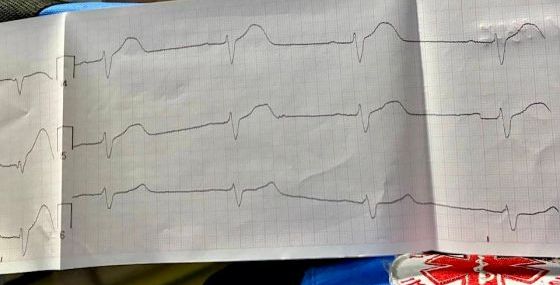 Срочный вызов в Рощино: борьба с инфарктом