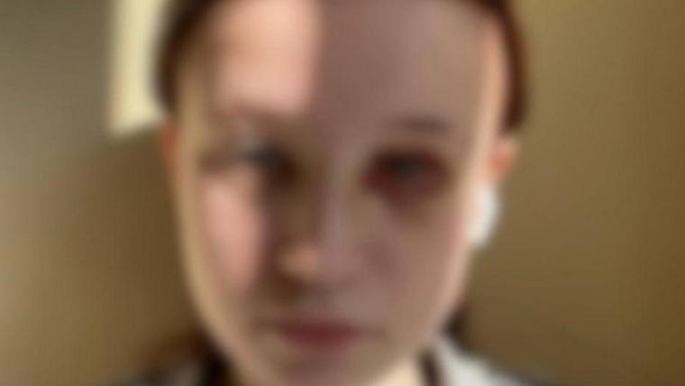 Жителей Выборгского района взволновало сообщение об избиении школьницы в Светогорске