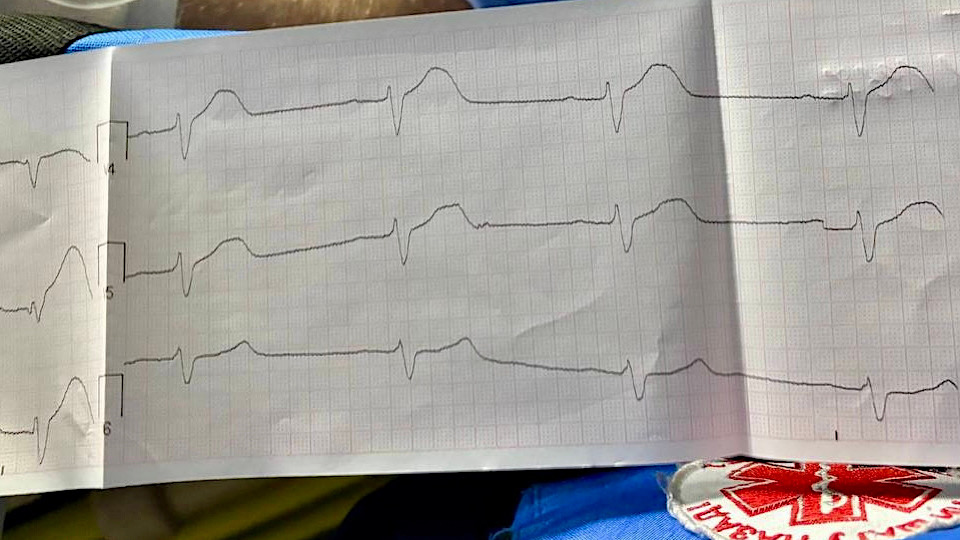 Срочный вызов в Рощино: борьба с инфарктом