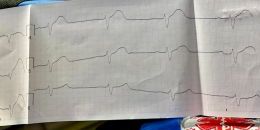 Срочный вызов в Рощино: борьба с инфарктом